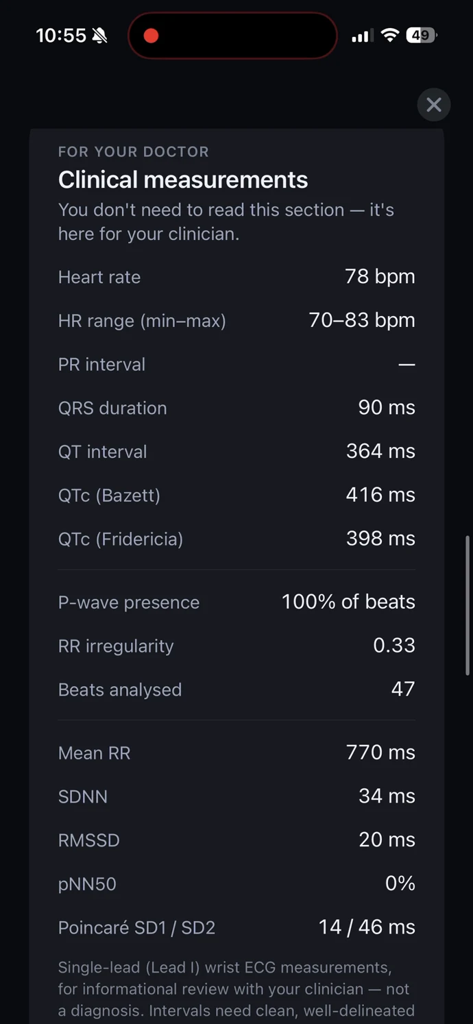 CarePlix CardiacPro ECG measurements report screen